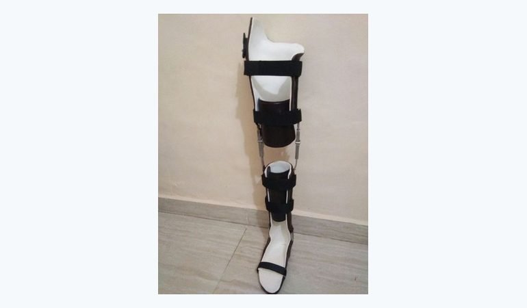 Full-length KAFO with metal uprights and leather cuffs made at Limbgenixx