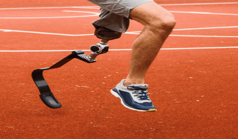 How to Walk with a Prosthetic Leg - Limbgenixx Blog