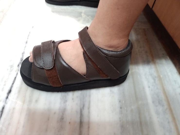Orthopaedic sandal fitted to a patient at Limbgenixx