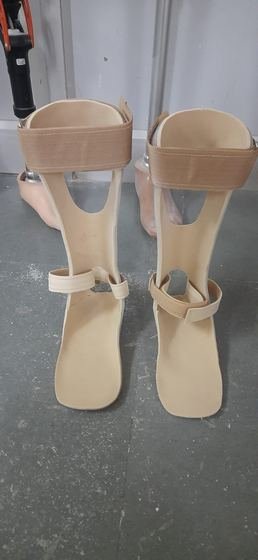 Moulded thermoplastic AFO pair made at Limbgenixx Gwalior