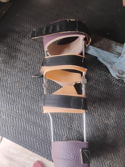 KAFO metal upright assembly during fabrication at Limbgenixx