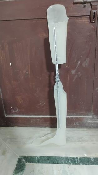 Polypropylene KAFO with knee joints, thigh and calf shells