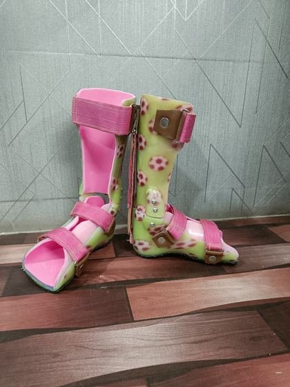 Custom paediatric AFO pair with patterned finish, made at Limbgenixx Gwalior