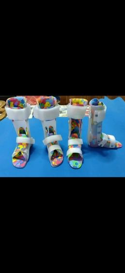 Range of paediatric AFOs in several sizes, made at Limbgenixx