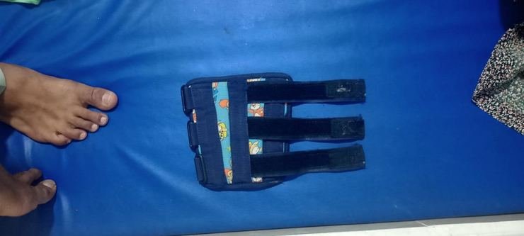 Paediatric wrist splint with patterned fabric finish
