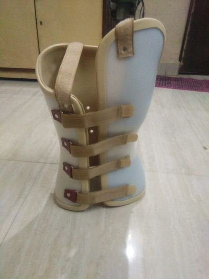 Moulded TLSO spinal orthosis made at Limbgenixx Gwalior