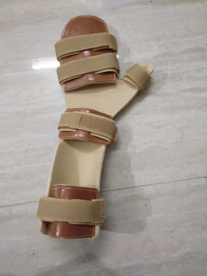 Custom wrist and hand orthosis with leather finish and strapping