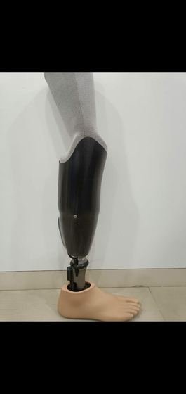 Below-knee prosthesis with carbon fibre socket fitted to a patient at Limbgenixx