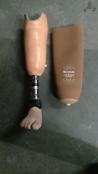 Below-knee prosthesis shown with an Ossur Iceross silicone liner