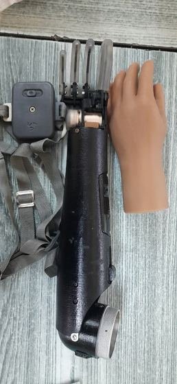 Body-powered below-elbow prosthetic arm assembly with harness