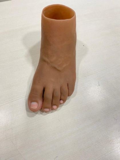 Custom silicone cosmetic prosthesis with individually finished detail
