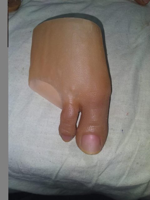 Silicone partial foot prosthesis restoring the forefoot and big toe, shown from above on a white cloth