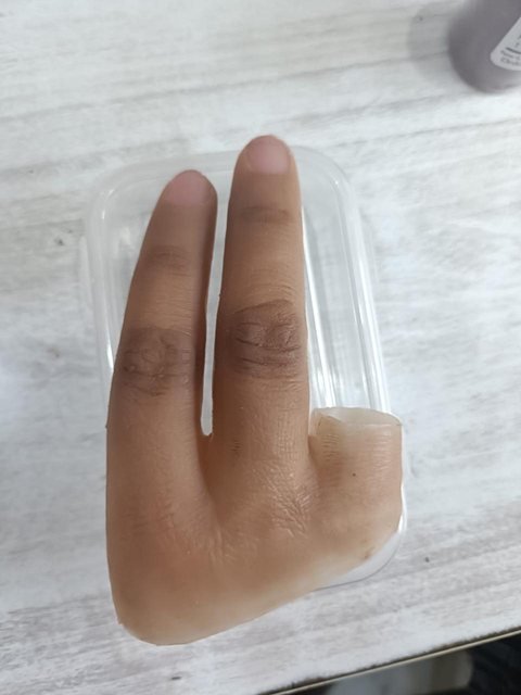 Silicone partial hand prosthesis replacing two fingers, with natural nails and knuckle creases, resting on a storage container