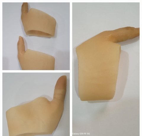Three views of a pale silicone partial hand prosthesis showing the cuff, the preserved thumb opening and the profile of the device