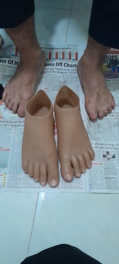 A pair of silicone foot prostheses with formed toes and toenails, photographed beside the wearer’s own feet for comparison
