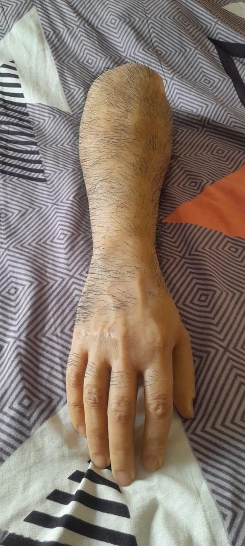 Silicone hand and forearm prosthesis in a mid-brown skin tone with individually implanted dark hair across the forearm and the back of the hand